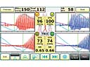 Atys Basic 3.4 měření ABI/TBI indexu