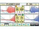 Atys Basic 3.4 měření ABI/TBI indexu