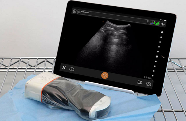 Clarius kapesní bezdrátový skener v diagnostice plicních funkcí v období boje s Covid-19